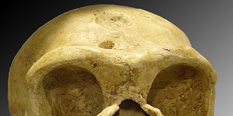 Data-driven research shows that Neanderthal gene connected to severity of COVID-19