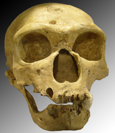 Data-driven research shows that Neanderthal gene connected to severity of COVID-19